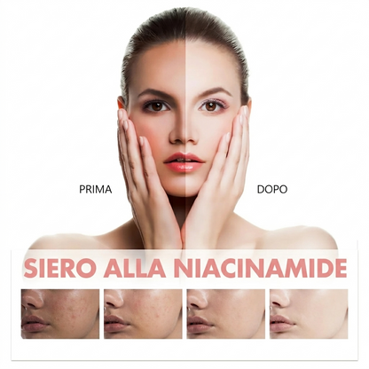 Siero alla Niacinamide e pesca